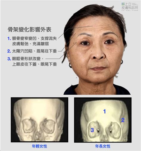 夫妻宮凹陷化解|紫微斗數 夫妻宮凹陷打什麼？解讀夫妻宮的意義與凹陷影響